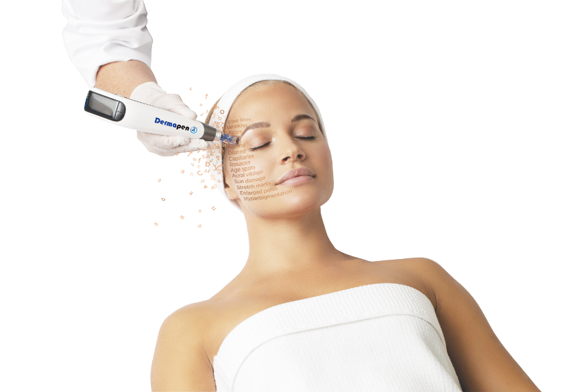 Dermapen microneedling huidverbetering littekens IJsselstein omgeving Schoonhoven en Benschop